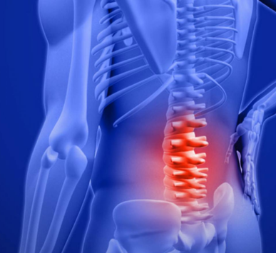 Non-Surgical vs. Surgical Spine Care: Managing Sciatica, Slipped Discs & Chronic Back Pain